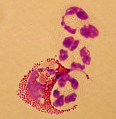 phagocytizing eosinophil